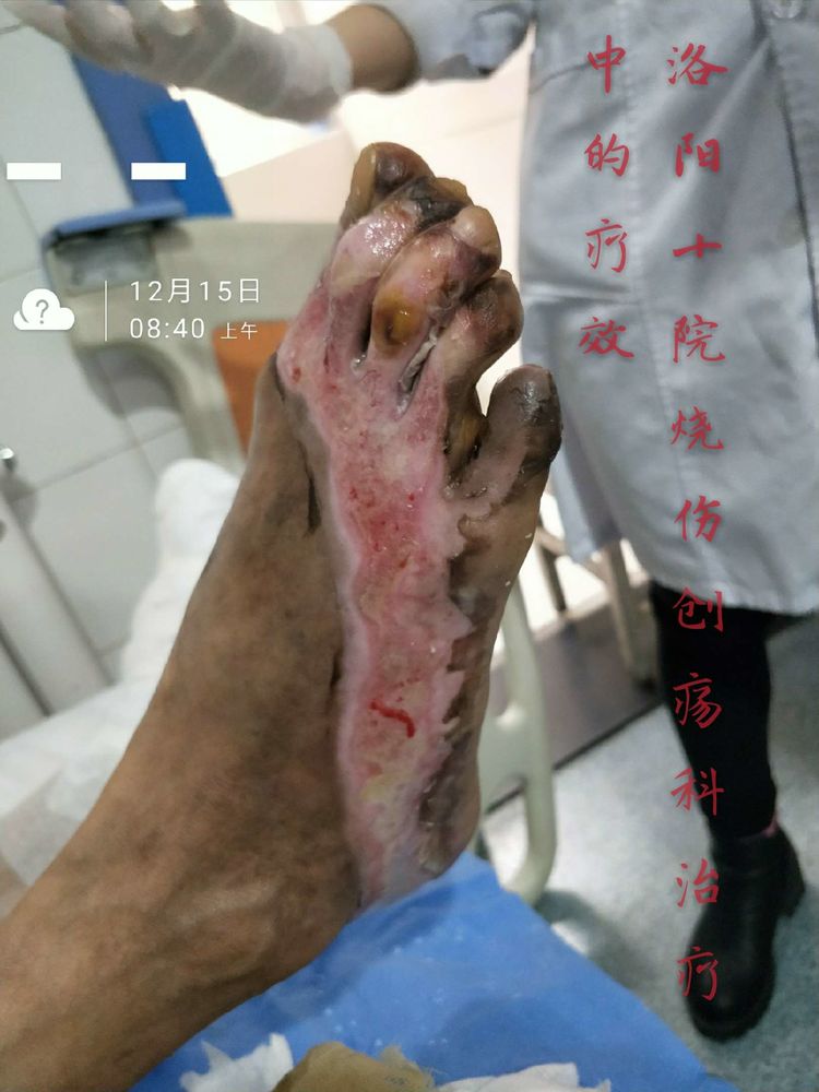 首页-BB贝博艾弗森公司官网