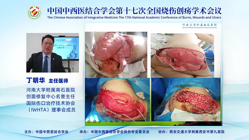 首页-BB贝博艾弗森公司官网
