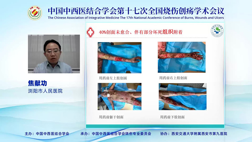 首页-BB贝博艾弗森公司官网