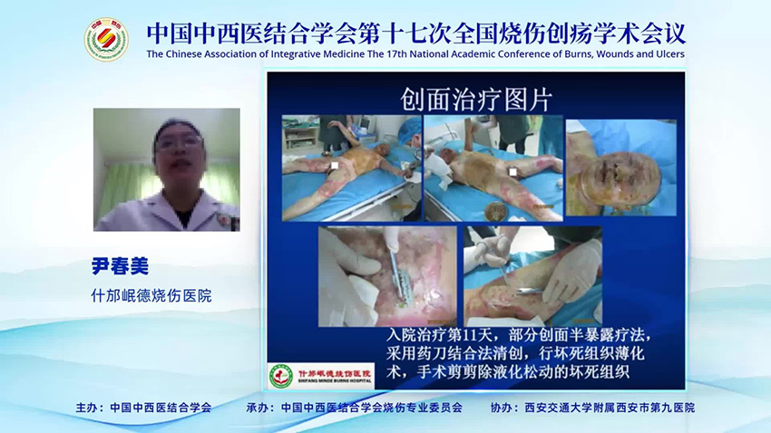 首页-BB贝博艾弗森公司官网