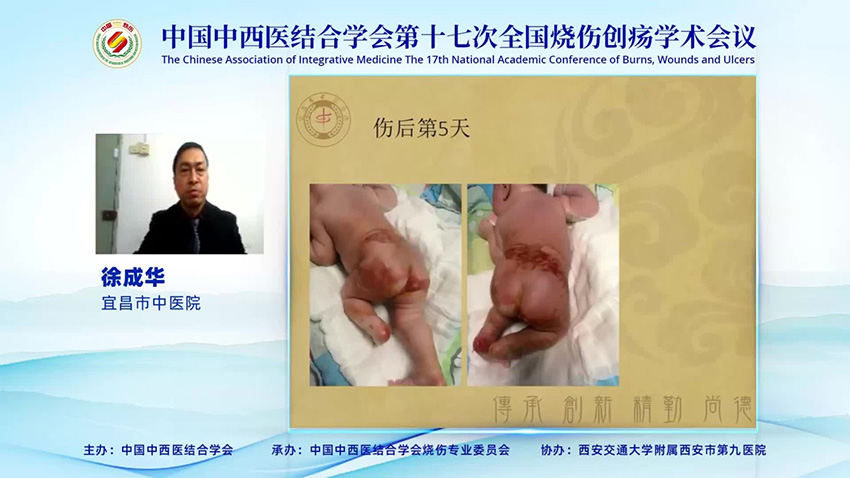 首页-BB贝博艾弗森公司官网