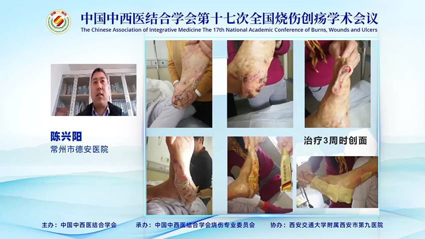 首页-BB贝博艾弗森公司官网