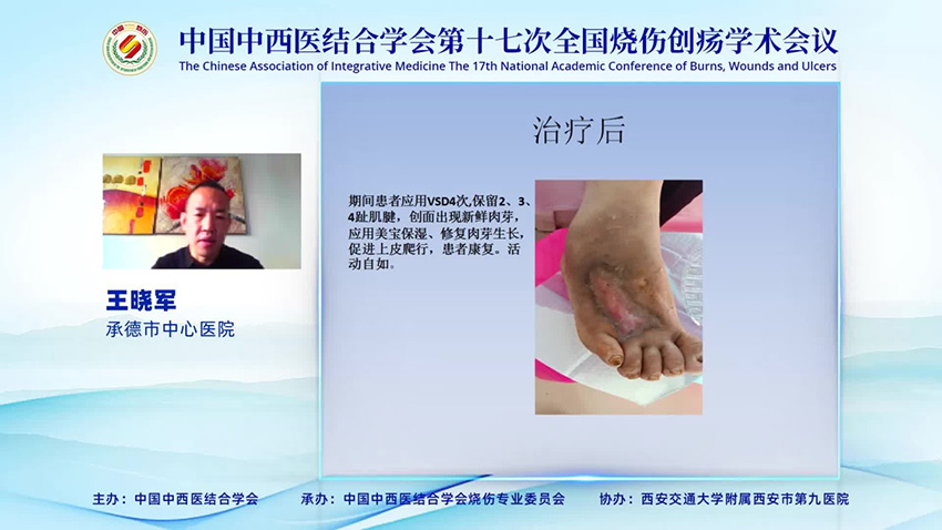 首页-BB贝博艾弗森公司官网