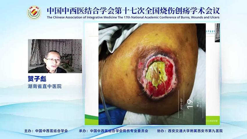 首页-BB贝博艾弗森公司官网