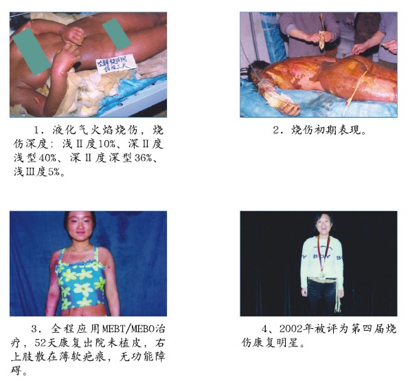 首页-BB贝博艾弗森公司官网